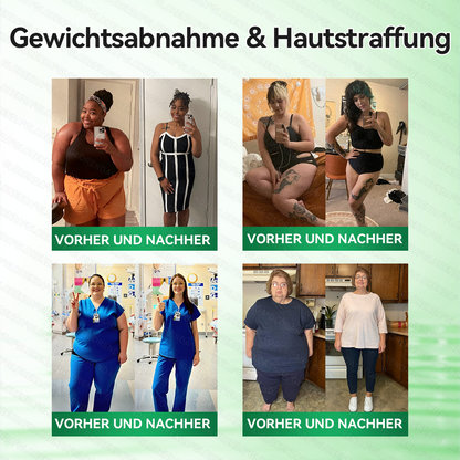 🇦🇹𝐎𝐟𝐟𝐢𝐳𝐢𝐞𝐥𝐥𝐞𝐫 𝐒𝐡𝐨𝐩 |🧀🧀𝑮𝑳𝑶𝐑𝐄𝐍𝐃𝘼®𝙈𝙤𝙧𝙞𝙣𝗴𝗮 · 𝗕𝗲𝗿𝗯𝗲𝗿𝒊𝒏 × 𝑵𝘼𝘿+ 10-𝙞𝙣-𝟏 𝐀𝐝𝐯𝐚𝗻𝗰𝗲𝗱 𝗡𝗮𝙣𝙤 𝙈𝙞𝙠𝙧𝐨𝐧𝐚𝐝𝐞𝐥-𝐏𝐚𝒕𝒄𝗵(𝐍𝐮𝐫 𝐞𝐢𝐧𝐦𝐚𝐥 𝐭ä𝐠𝐥𝐢𝐜𝐡, 𝐬𝐢𝐜𝐡𝐭𝐛𝐚𝐫𝐞 𝐕𝐞𝐫ä𝐧𝐝𝐞𝐫𝐮𝐧𝐠𝐞𝐧 𝐢𝐧 𝟕 𝐓𝐚𝐠𝐞𝐧)✅ 𝐅ü𝐫 𝐅𝐞𝐭𝐭𝐥𝐞𝐢𝐛𝐢𝐠𝐤𝐞𝐢𝐭, 𝐇𝐚𝐮𝐭𝐬𝐭𝐫𝐚𝐟𝐟𝐮𝐧𝐠, 𝐃𝐢𝐚𝐛𝐞𝐭𝐞𝐬, 𝐒𝐜𝐡𝐥𝐚𝐟𝐚𝐩𝐧𝐨𝐞, 𝐆𝐞𝐥𝐞𝐧𝐤𝐩𝐫𝐨𝐛𝐥𝐞𝐦𝐞 𝐮𝐧𝐝 𝐦𝐞𝐡𝐫!