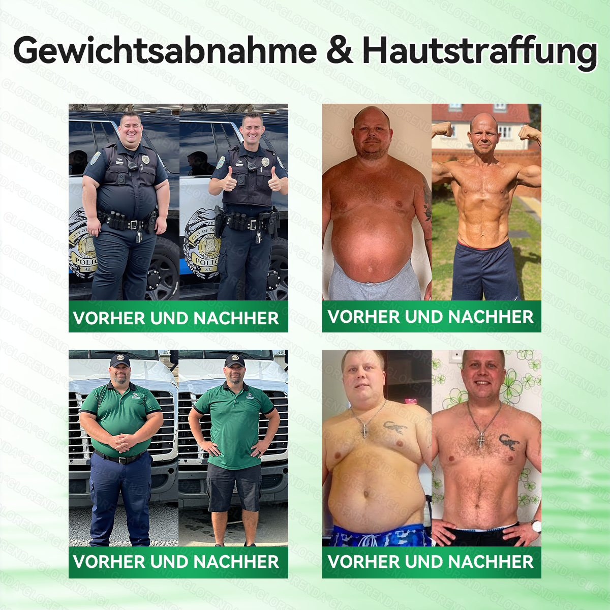 🇦🇹𝐎𝐟𝐟𝐢𝐳𝐢𝐞𝐥𝐥𝐞𝐫 𝐒𝐡𝐨𝐩 |🧀🧀𝑮𝑳𝑶𝐑𝐄𝐍𝐃𝘼®𝙈𝙤𝙧𝙞𝙣𝗴𝗮 · 𝗕𝗲𝗿𝗯𝗲𝗿𝒊𝒏 × 𝑵𝘼𝘿+ 10-𝙞𝙣-𝟏 𝐀𝐝𝐯𝐚𝗻𝗰𝗲𝗱 𝗡𝗮𝙣𝙤 𝙈𝙞𝙠𝙧𝐨𝐧𝐚𝐝𝐞𝐥-𝐏𝐚𝒕𝒄𝗵(𝐍𝐮𝐫 𝐞𝐢𝐧𝐦𝐚𝐥 𝐭ä𝐠𝐥𝐢𝐜𝐡, 𝐬𝐢𝐜𝐡𝐭𝐛𝐚𝐫𝐞 𝐕𝐞𝐫ä𝐧𝐝𝐞𝐫𝐮𝐧𝐠𝐞𝐧 𝐢𝐧 𝟕 𝐓𝐚𝐠𝐞𝐧)✅ 𝐅ü𝐫 𝐅𝐞𝐭𝐭𝐥𝐞𝐢𝐛𝐢𝐠𝐤𝐞𝐢𝐭, 𝐇𝐚𝐮𝐭𝐬𝐭𝐫𝐚𝐟𝐟𝐮𝐧𝐠, 𝐃𝐢𝐚𝐛𝐞𝐭𝐞𝐬, 𝐒𝐜𝐡𝐥𝐚𝐟𝐚𝐩𝐧𝐨𝐞, 𝐆𝐞𝐥𝐞𝐧𝐤𝐩𝐫𝐨𝐛𝐥𝐞𝐦𝐞 𝐮𝐧𝐝 𝐦𝐞𝐡𝐫!
