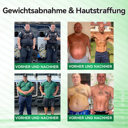 🇦🇹𝐎𝐟𝐟𝐢𝐳𝐢𝐞𝐥𝐥𝐞𝐫 𝐒𝐡𝐨𝐩 |🧀🧀𝑮𝑳𝑶𝐑𝐄𝐍𝐃𝘼®𝙈𝙤𝙧𝙞𝙣𝗴𝗮 · 𝗕𝗲𝗿𝗯𝗲𝗿𝒊𝒏 × 𝑵𝘼𝘿+ 10-𝙞𝙣-𝟏 𝐀𝐝𝐯𝐚𝗻𝗰𝗲𝗱 𝗡𝗮𝙣𝙤 𝙈𝙞𝙠𝙧𝐨𝐧𝐚𝐝𝐞𝐥-𝐏𝐚𝒕𝒄𝗵(𝐍𝐮𝐫 𝐞𝐢𝐧𝐦𝐚𝐥 𝐭ä𝐠𝐥𝐢𝐜𝐡, 𝐬𝐢𝐜𝐡𝐭𝐛𝐚𝐫𝐞 𝐕𝐞𝐫ä𝐧𝐝𝐞𝐫𝐮𝐧𝐠𝐞𝐧 𝐢𝐧 𝟕 𝐓𝐚𝐠𝐞𝐧)✅ 𝐅ü𝐫 𝐅𝐞𝐭𝐭𝐥𝐞𝐢𝐛𝐢𝐠𝐤𝐞𝐢𝐭, 𝐇𝐚𝐮𝐭𝐬𝐭𝐫𝐚𝐟𝐟𝐮𝐧𝐠, 𝐃𝐢𝐚𝐛𝐞𝐭𝐞𝐬, 𝐒𝐜𝐡𝐥𝐚𝐟𝐚𝐩𝐧𝐨𝐞, 𝐆𝐞𝐥𝐞𝐧𝐤𝐩𝐫𝐨𝐛𝐥𝐞𝐦𝐞 𝐮𝐧𝐝 𝐦𝐞𝐡𝐫!