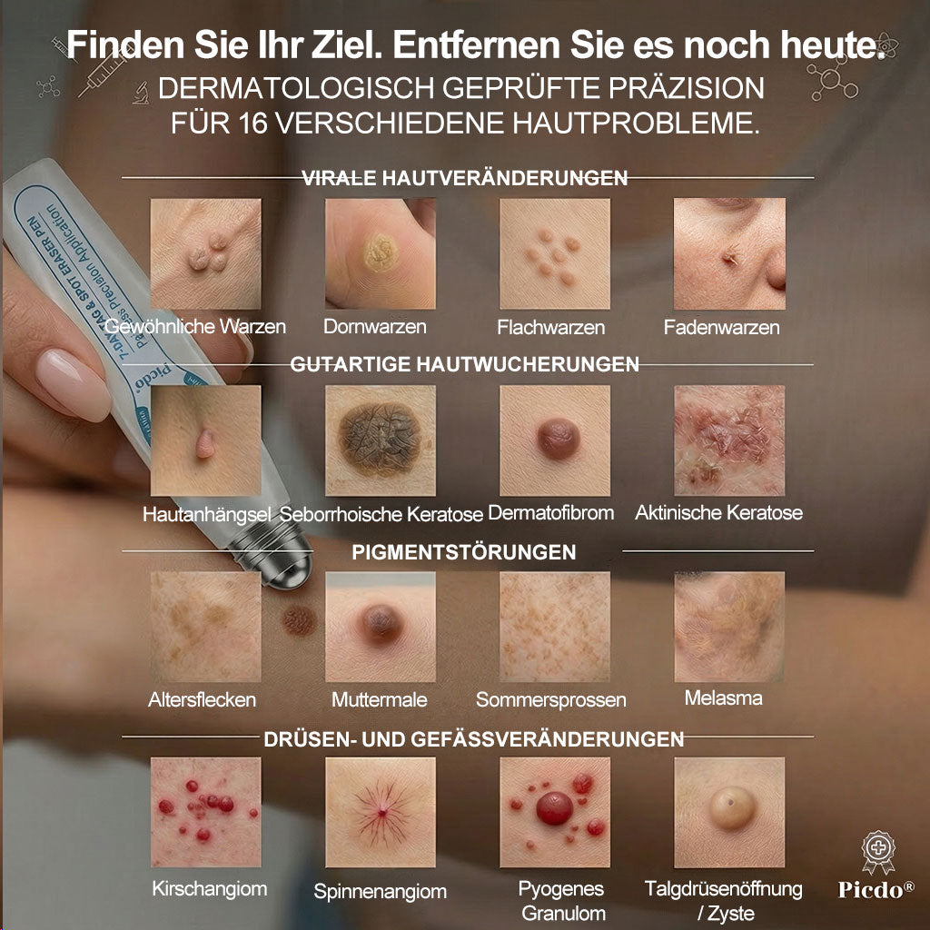 Offizieller Markenstore |🎀🎀𝑷𝑖𝒄𝐝𝐨® 7-𝑻𝒂𝒈𝒆 𝑯𝒂𝒖𝒕𝒂𝒏𝒉ä𝒏𝒈𝒔𝒆𝒍- & 𝑭𝒍𝒆𝒄𝒌𝒆𝒏𝒆𝒏𝒕𝒇𝒆𝒓𝒏𝒆𝒓(Schmerzfreier Rollerball – Keine Narbenbildung)🚀