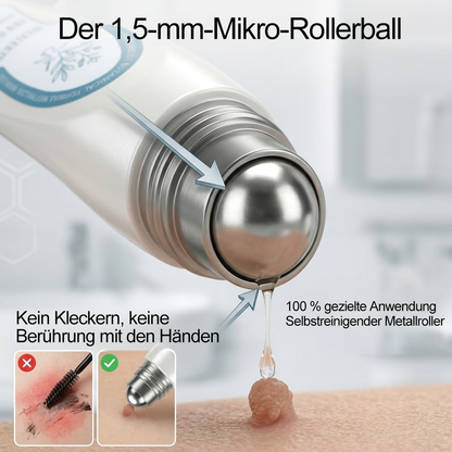 Offizieller Markenstore |🎀🎀𝑷𝑖𝒄𝐝𝐨® 7-𝑻𝒂𝒈𝒆 𝑯𝒂𝒖𝒕𝒂𝒏𝒉ä𝒏𝒈𝒔𝒆𝒍- & 𝑭𝒍𝒆𝒄𝒌𝒆𝒏𝒆𝒏𝒕𝒇𝒆𝒓𝒏𝒆𝒓(Schmerzfreier Rollerball – Keine Narbenbildung)🚀