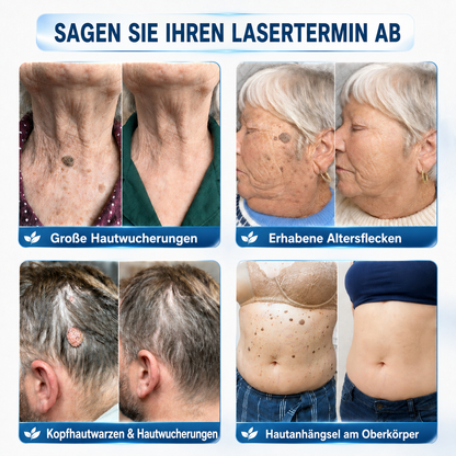 👩‍⚕️🏆 𝑶𝒇𝒇𝒊𝒛𝒊𝒆𝒍𝒍𝒆𝒓 𝑺𝒕𝒐𝒓𝒆 | 𝑵𝐞𝒌𝐢𝐬𝐬® 🌿 𝑴𝒊𝒌𝒓𝒐𝒏𝒂𝒅𝒆𝒍𝒏 𝑴𝒂𝒌𝒆𝒍𝒍𝒐𝒔𝒆 𝑯𝒂𝒖𝒕 𝑯𝒂𝒖𝒕 𝑾𝒂𝒓𝒛𝒆 𝑬𝒏𝒕𝒇𝒆𝒓𝒏𝒖𝒏𝒈 𝑷𝒇𝒍𝒂𝒔𝒕𝒆𝒓 (𝐹ü𝑟 𝐻𝑎𝑢𝑡𝑎𝑛ℎä𝑛𝑔𝑠𝑒𝑙, 𝑘𝑙𝑒𝑖𝑛𝑒 𝐻𝑎𝑢𝑡𝑤𝑢𝑐ℎ𝑒𝑟𝑢𝑛𝑔𝑒𝑛, 𝑊𝑎𝑟𝑧𝑒𝑛, 𝑀𝑢𝑡𝑡𝑒𝑟𝑚𝑎𝑙𝑒, 𝐴𝑙𝑡𝑒𝑟𝑠𝑓𝑙𝑒𝑐𝑘𝑒𝑛 𝑢𝑛𝑑 𝑃𝑖𝑔𝑚𝑒𝑛𝑡𝑠𝑡ö𝑟𝑢𝑛𝑔𝑒𝑛.)
