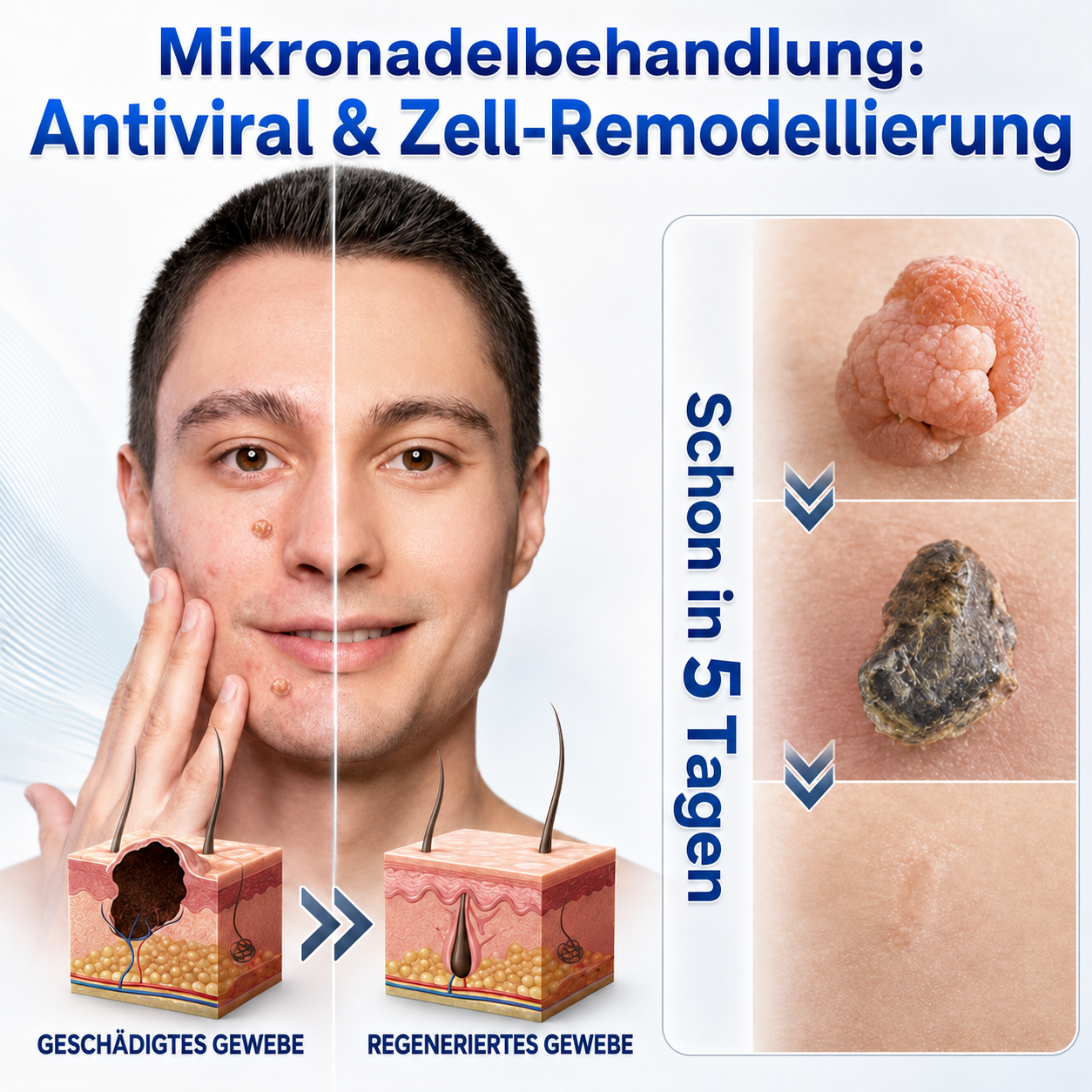 👩‍⚕️🏆 𝑶𝒇𝒇𝒊𝒛𝒊𝒆𝒍𝒍𝒆𝒓 𝑺𝒕𝒐𝒓𝒆 | 𝑵𝐞𝒌𝐢𝐬𝐬® 🌿 𝑴𝒊𝒌𝒓𝒐𝒏𝒂𝒅𝒆𝒍𝒏 𝑴𝒂𝒌𝒆𝒍𝒍𝒐𝒔𝒆 𝑯𝒂𝒖𝒕 𝑯𝒂𝒖𝒕 𝑾𝒂𝒓𝒛𝒆 𝑬𝒏𝒕𝒇𝒆𝒓𝒏𝒖𝒏𝒈 𝑷𝒇𝒍𝒂𝒔𝒕𝒆𝒓 (𝐹ü𝑟 𝐻𝑎𝑢𝑡𝑎𝑛ℎä𝑛𝑔𝑠𝑒𝑙, 𝑘𝑙𝑒𝑖𝑛𝑒 𝐻𝑎𝑢𝑡𝑤𝑢𝑐ℎ𝑒𝑟𝑢𝑛𝑔𝑒𝑛, 𝑊𝑎𝑟𝑧𝑒𝑛, 𝑀𝑢𝑡𝑡𝑒𝑟𝑚𝑎𝑙𝑒, 𝐴𝑙𝑡𝑒𝑟𝑠𝑓𝑙𝑒𝑐𝑘𝑒𝑛 𝑢𝑛𝑑 𝑃𝑖𝑔𝑚𝑒𝑛𝑡𝑠𝑡ö𝑟𝑢𝑛𝑔𝑒𝑛.)