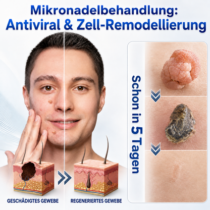 👩‍⚕️🏆 𝑶𝒇𝒇𝒊𝒛𝒊𝒆𝒍𝒍𝒆𝒓 𝑺𝒕𝒐𝒓𝒆 | 𝑵𝐞𝒌𝐢𝐬𝐬® 🌿 𝑴𝒊𝒌𝒓𝒐𝒏𝒂𝒅𝒆𝒍𝒏 𝑴𝒂𝒌𝒆𝒍𝒍𝒐𝒔𝒆 𝑯𝒂𝒖𝒕 𝑯𝒂𝒖𝒕 𝑾𝒂𝒓𝒛𝒆 𝑬𝒏𝒕𝒇𝒆𝒓𝒏𝒖𝒏𝒈 𝑷𝒇𝒍𝒂𝒔𝒕𝒆𝒓 (𝐹ü𝑟 𝐻𝑎𝑢𝑡𝑎𝑛ℎä𝑛𝑔𝑠𝑒𝑙, 𝑘𝑙𝑒𝑖𝑛𝑒 𝐻𝑎𝑢𝑡𝑤𝑢𝑐ℎ𝑒𝑟𝑢𝑛𝑔𝑒𝑛, 𝑊𝑎𝑟𝑧𝑒𝑛, 𝑀𝑢𝑡𝑡𝑒𝑟𝑚𝑎𝑙𝑒, 𝐴𝑙𝑡𝑒𝑟𝑠𝑓𝑙𝑒𝑐𝑘𝑒𝑛 𝑢𝑛𝑑 𝑃𝑖𝑔𝑚𝑒𝑛𝑡𝑠𝑡ö𝑟𝑢𝑛𝑔𝑒𝑛.)